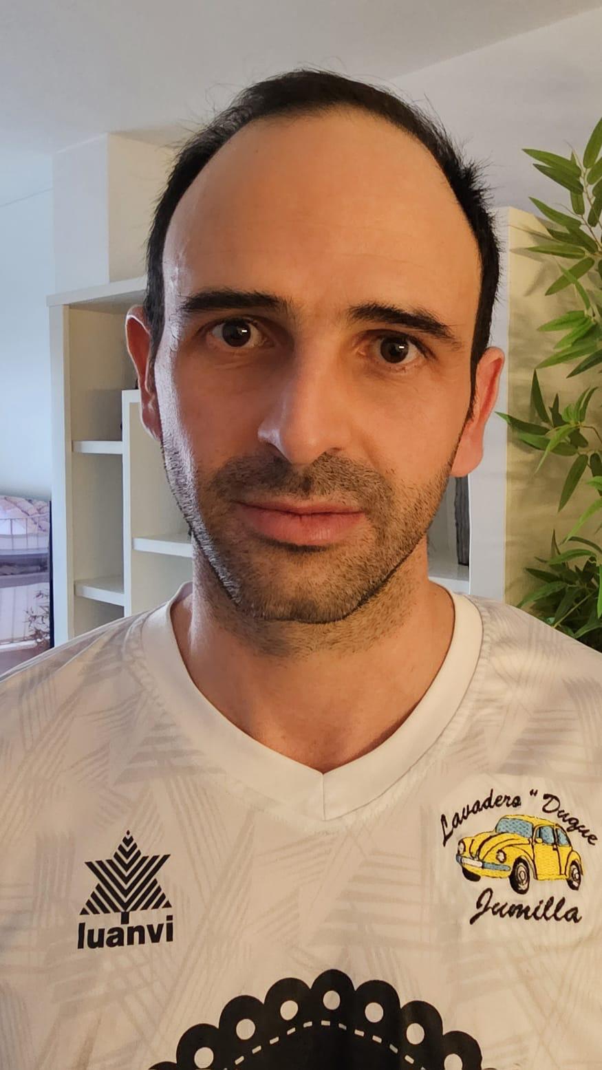 Antonio Exojo Lopez