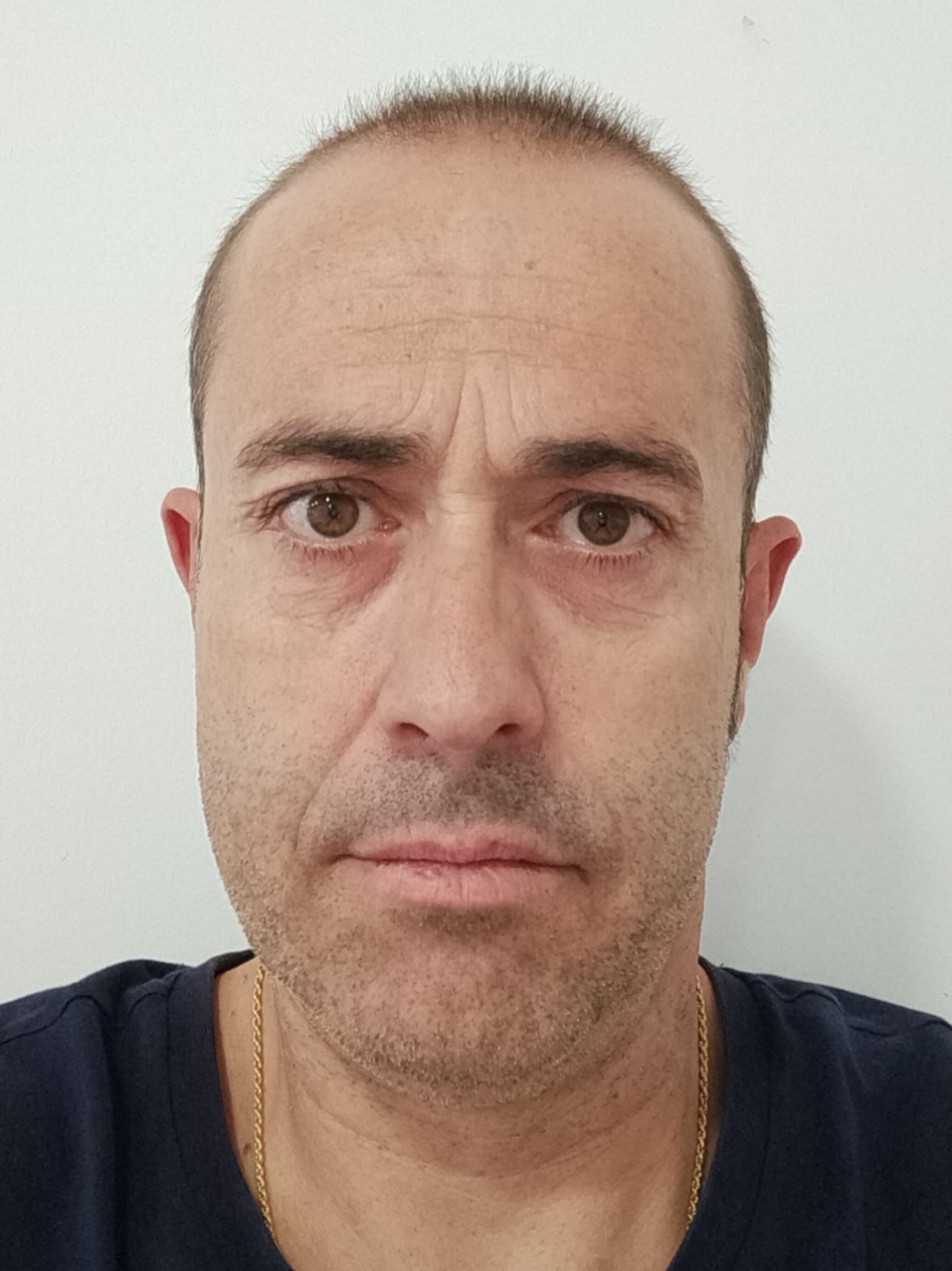 eloy vivo lozano